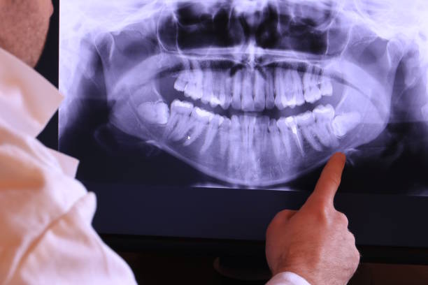 Best Emergency Tooth Extraction  in Belgium, WI